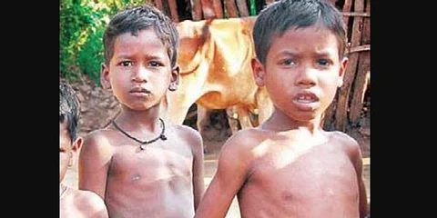 Malnourished children (File photo)