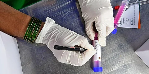 For representational purpose. (File photo | Shriram BN)