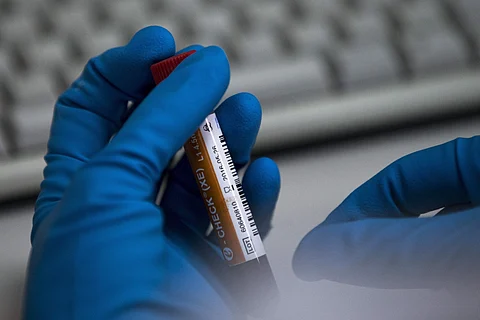 Image used for representational purposes