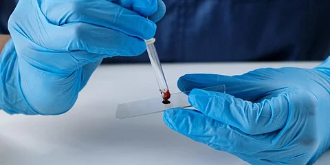 Image used for representational purposes