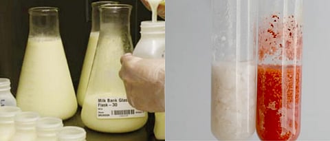 milk adulteration