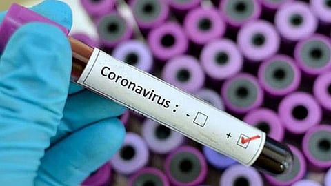 الحالات الحرجة لمرضى كورونا