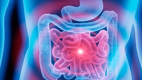 بكتيريا المعدة