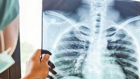 صورة بالأشعة السينية