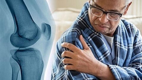 سرطان العظام