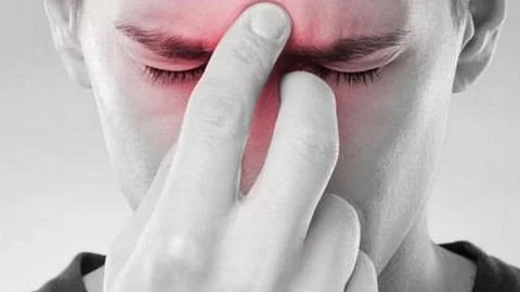صداع الجيوب الأنفية