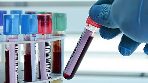 نفايات كورونا