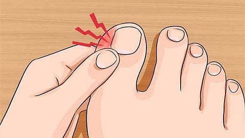 أسباب نمو أظافر القدم للداخل 