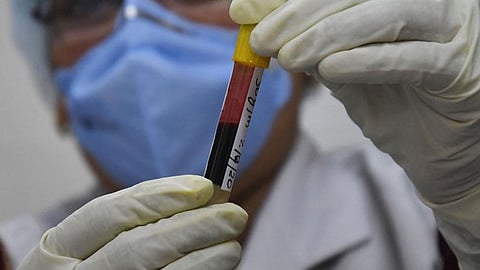 أنبوب اختبار فيروس كورونا