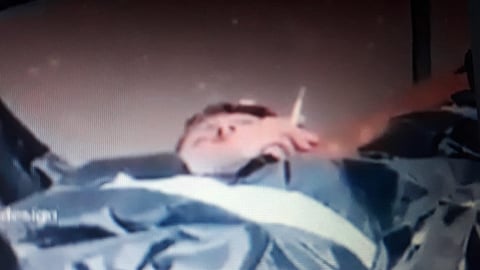 حقيقة الجثة المدخنة للسجائر في أوكرانيا