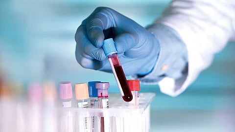 إجراء تحاليل نقص الحديد، أرشيفية