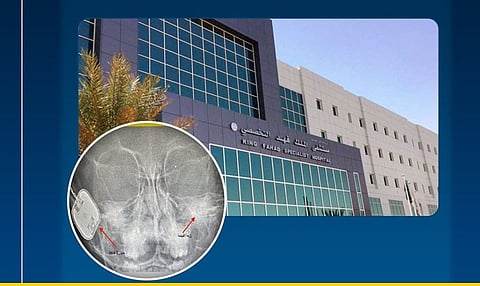 مستشفى الملك فهد بتبوك