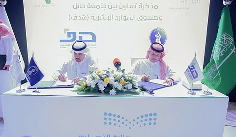 مذكرة تعاون بين هدف وجامعة حائل