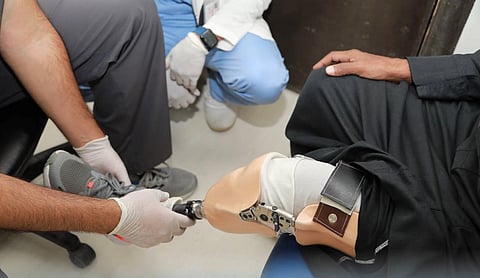 تركيب طرف صناعي بجازان