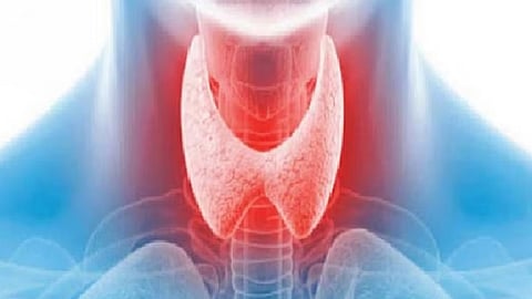 مرض الغدة الدرقية