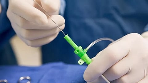 عملية بالقلب - ارشيفية