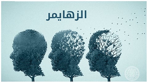 الزهايمر