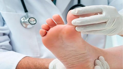 القدم السكرية