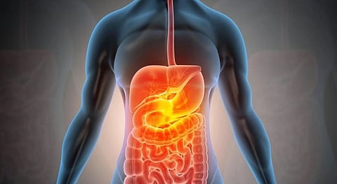 مشكلات الجهاز الهضميش