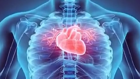 متلازمة القلب السعيد