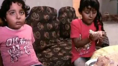 يأكلان اللحوم نيئة.. طفلان مصريان يعانيان من مرض نادر