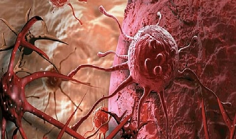 مادة لحرق الأورام الخبيثة