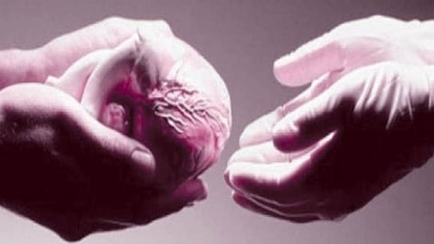 التبرع بالأعضاء بعد الوفاة