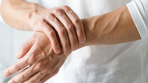 التهاب المفاصل