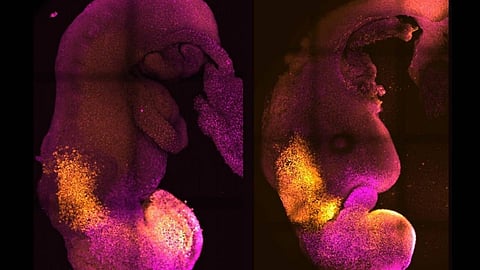 خلايا جذعية