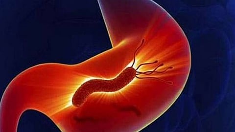 طرق الوقاية من الإصابة بجرثومة المعدة