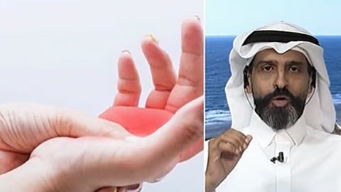 استشاري طب المخ والأعصاب الدكتور فوزي بابطين