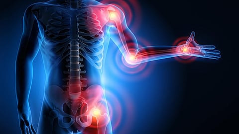 سرطان العظام