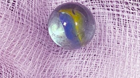 طفلة تبتلع جسما غريبا في ينبع