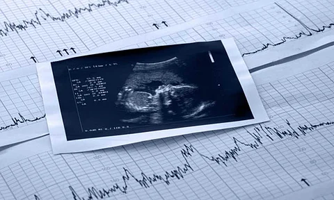 فحوصات تكشف عن الإصابة بمتلازمة داون