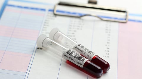 فحص ما قبل الزواج