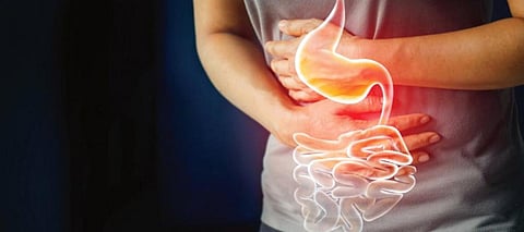 القولون العصبي