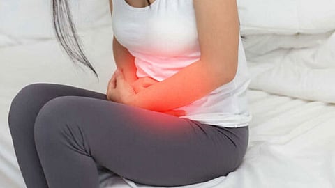 تكيس المبيض