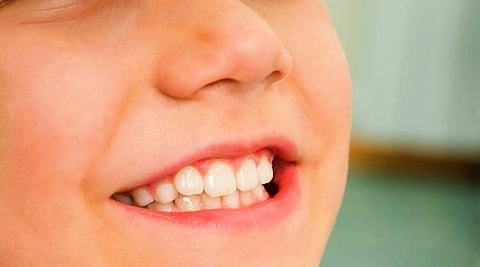 أسنان الأطفال الأولى