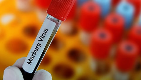 أعراض فيروس ماربورغ