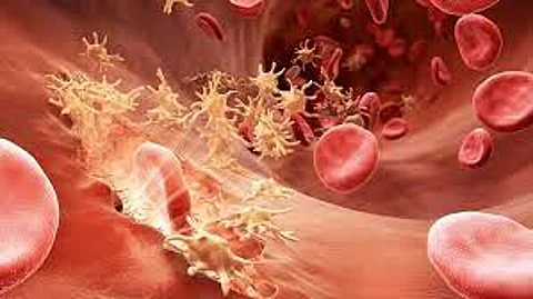 تجمع الرياض الصحي الأول: 8 أعراض للإصابة بالهيموفيليا