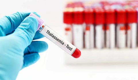 أعراض اضطراب الثلاسيميا