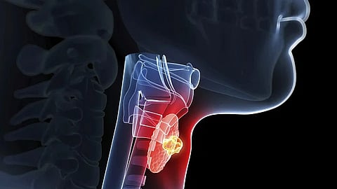 الغدة الدرقية