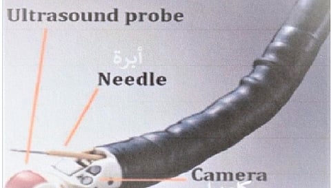 جهاز علاج المرئ