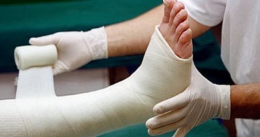 أعراض كسر العظام