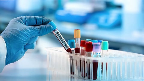 أنواع سرطان الدم