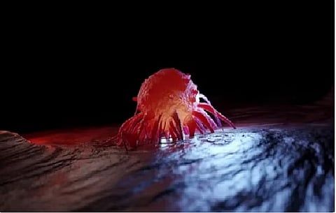 مرض السرطان