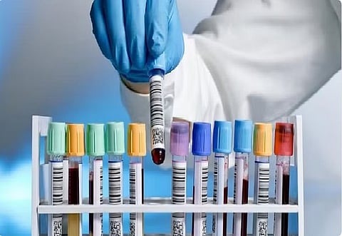 فحوصات ما قبل الزواج