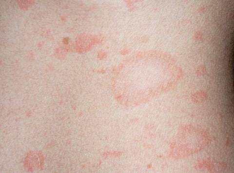 النخالية الوردية