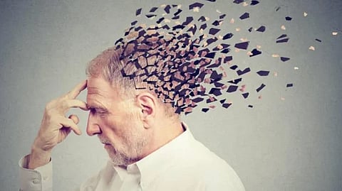 ألزهايمر