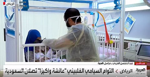 الوضع الطبي للتوأم السيامي الفلبيني